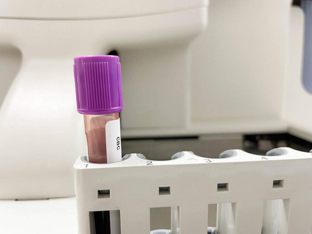 Purple test tube EDTA blood in cbc test. veterinary blood test for pets